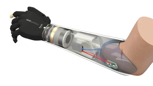 Internal components of Supro Wrist prosthetic arm by InfoTec