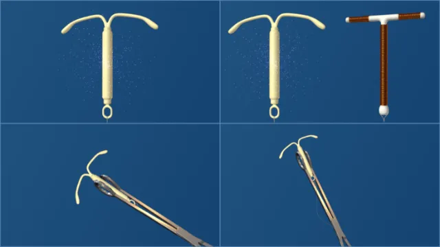 Medical illustration of loop
