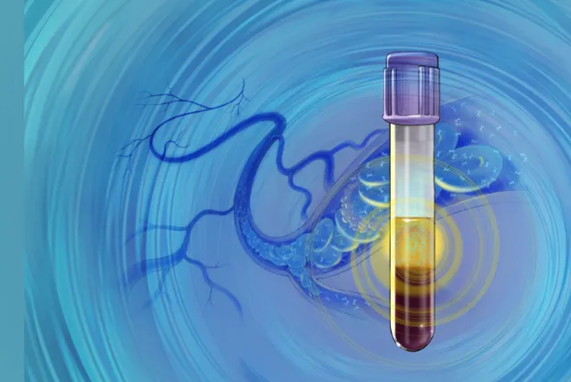 Yellow liquid in test tube with vein-like swirling design