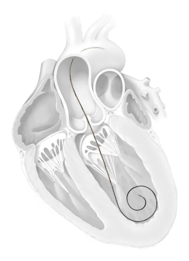 Cross-section of the human heart anatomy by Alex Webber