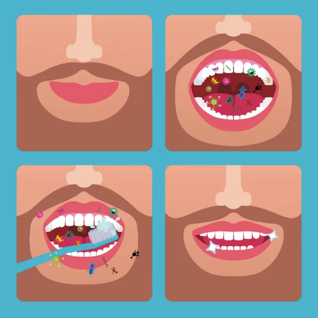 Mouth with germs, teeth brushing, and clean teeth sequence illustration