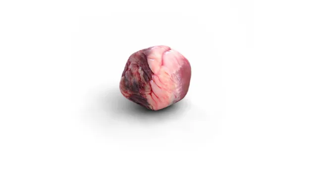 3d medical illustration